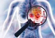 Photo of Inflammation and Aging: Unraveling the Drivers of Postmenopausal Breast Cancer Progression
