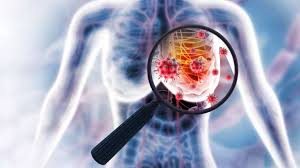 Photo of Inflammation and Aging: Unraveling the Drivers of Postmenopausal Breast Cancer Progression